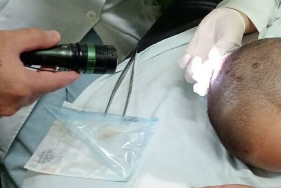 Imagem de compartilhamento para o artigo Menina de 7 anos é internada às pressas com larvas na cabeça em Dourados da MS Todo dia